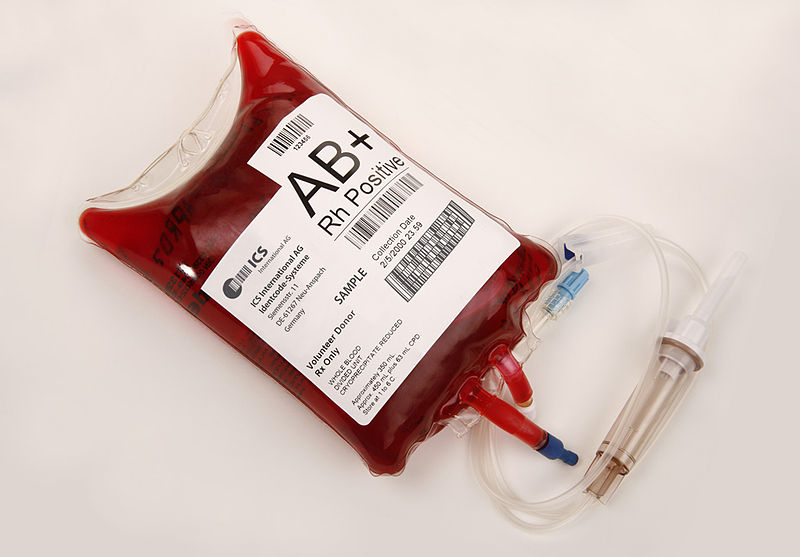 Bloodbbag filled with AB+ blood. Photo Credit: ICSident