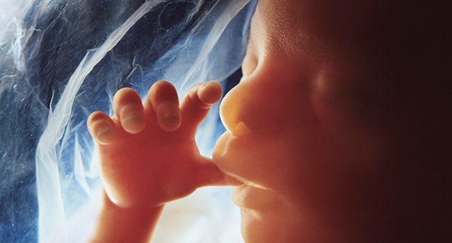Right to Choose Versus The Right to Life